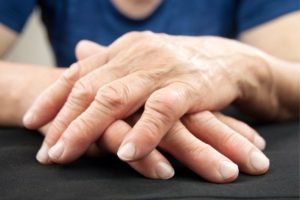 Rheumatoide Arthritis Behandlung: Wie ganzheitliche Ansätze helfen können